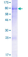 12.5% SDS-PAGE Stained with Coomassie Blue.